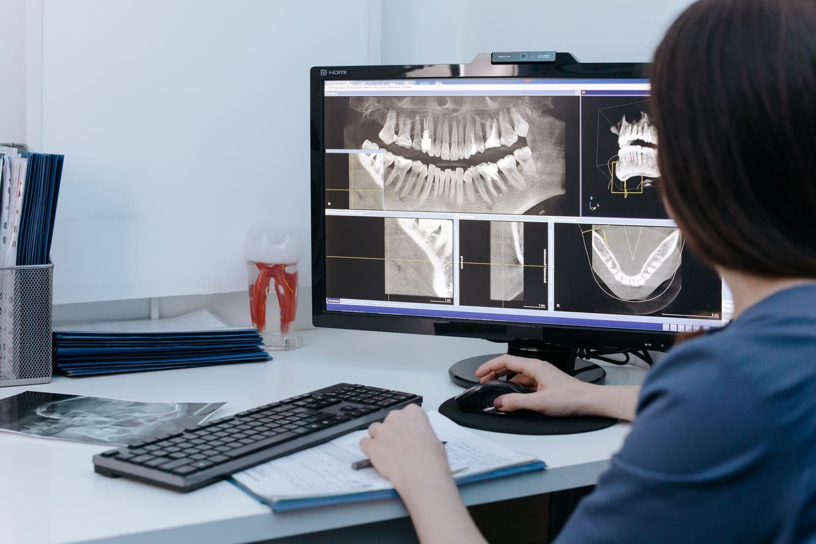 A dental clinician reviews panoramic and sectional x-rays on a desktop monitor beside a keyboard and a clipboard