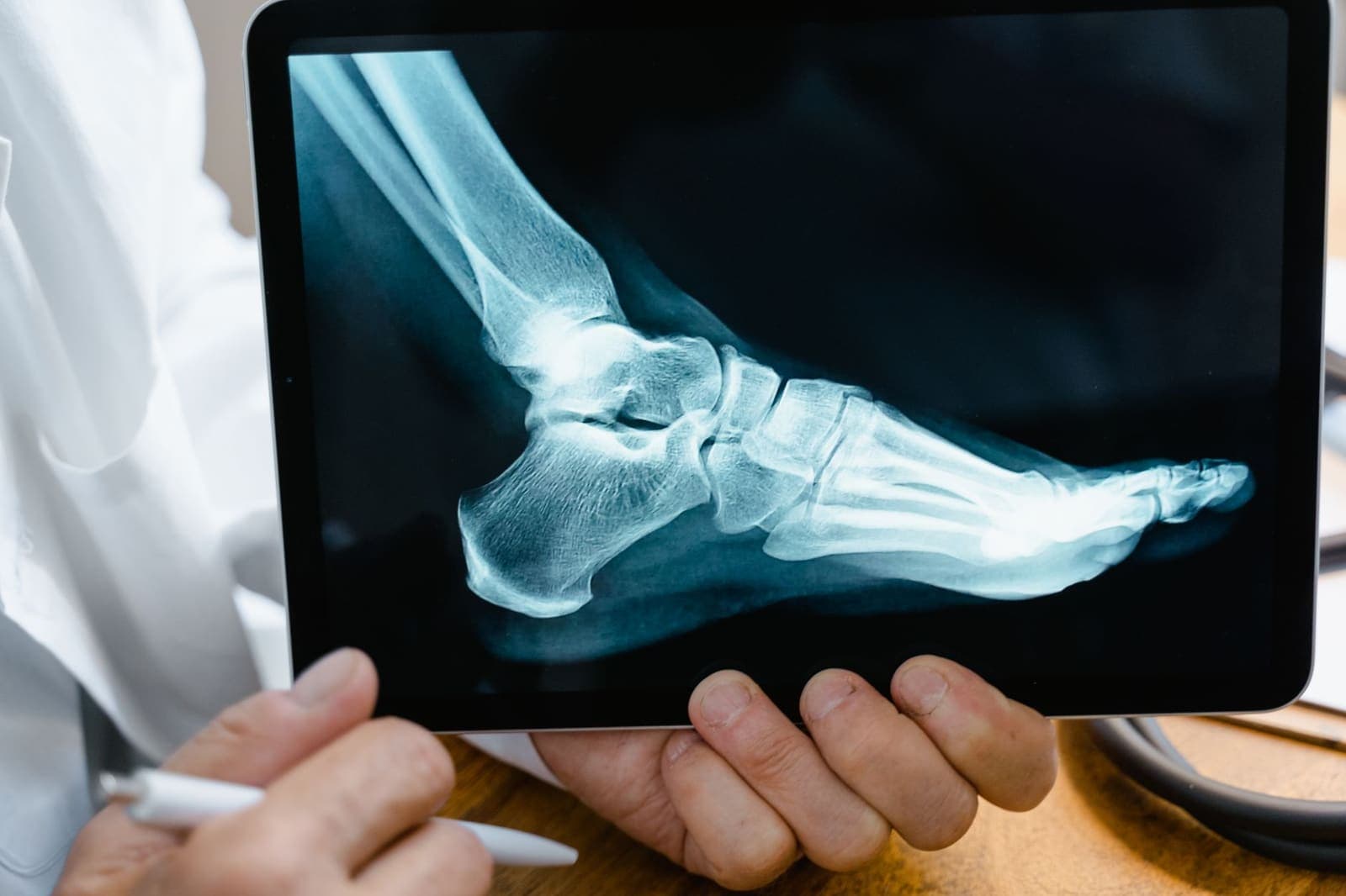 A clinician holds a tablet showing a side-view X-ray of a foot and ankle